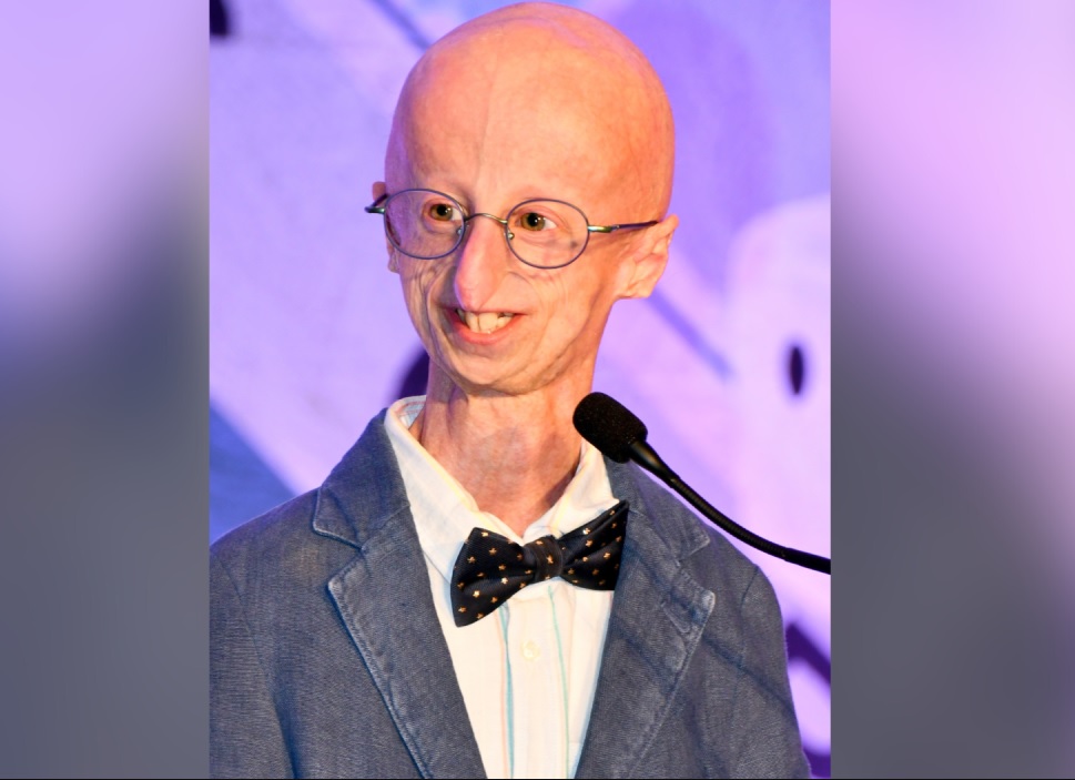 TOP PAY Keajaiban Sammy Basso Berakhir, Penyintas Penyakit Langka Progeria Itu Meninggal Dunia