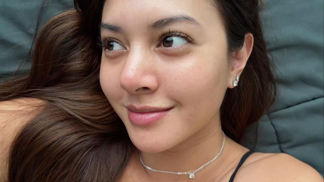 Cerita Aurelie Moeremans Sempat Ketergantungan Filter Medsos, Sampai Jadi Kurang Pede